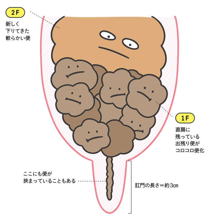 毎日便が出るからと言って「全部出ている」わけじゃない？ 勘違いしがちな「便秘」の定義 27.jpg