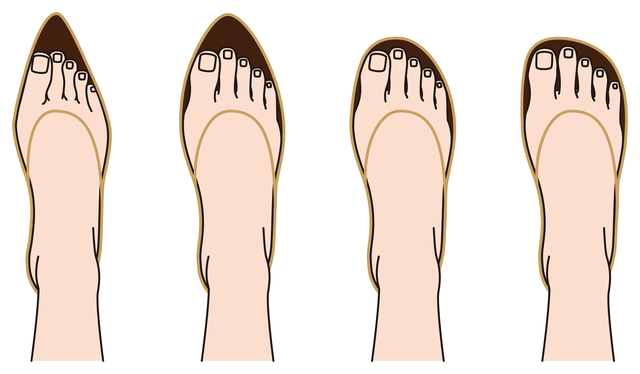 足のタイプに合った正しい靴を選べば爪は変わります 足の爪の変形 毎日が発見ネット