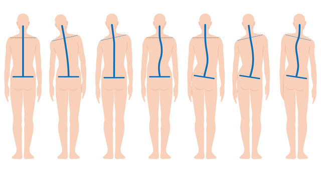 手指の病気には首、肩、腰の位置が関係している！ 正しい位置をチェック pixta_36058544_S.jpg