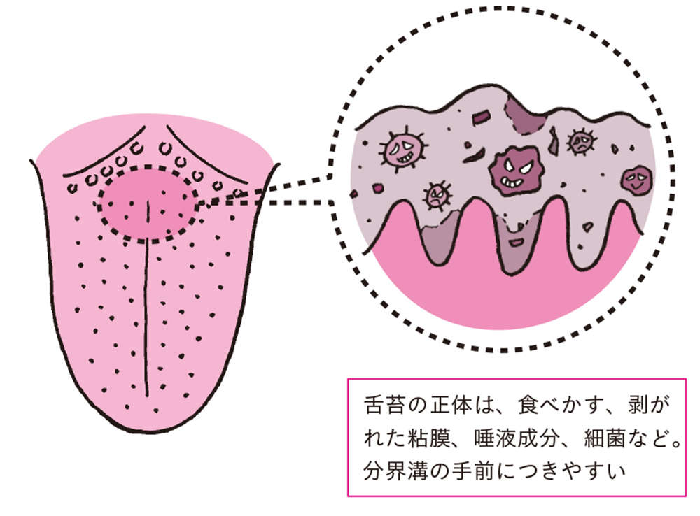 舌を見れば、カラダの不調がわかる！ 「正常な舌の特徴」5つ【チェックリストあり】 shitakoso29.jpg