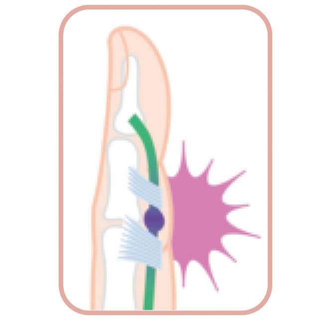 セルフチェックで手指の病気を自己診断！ あなたはどこに痛みを感じますか? P041_02.jpg