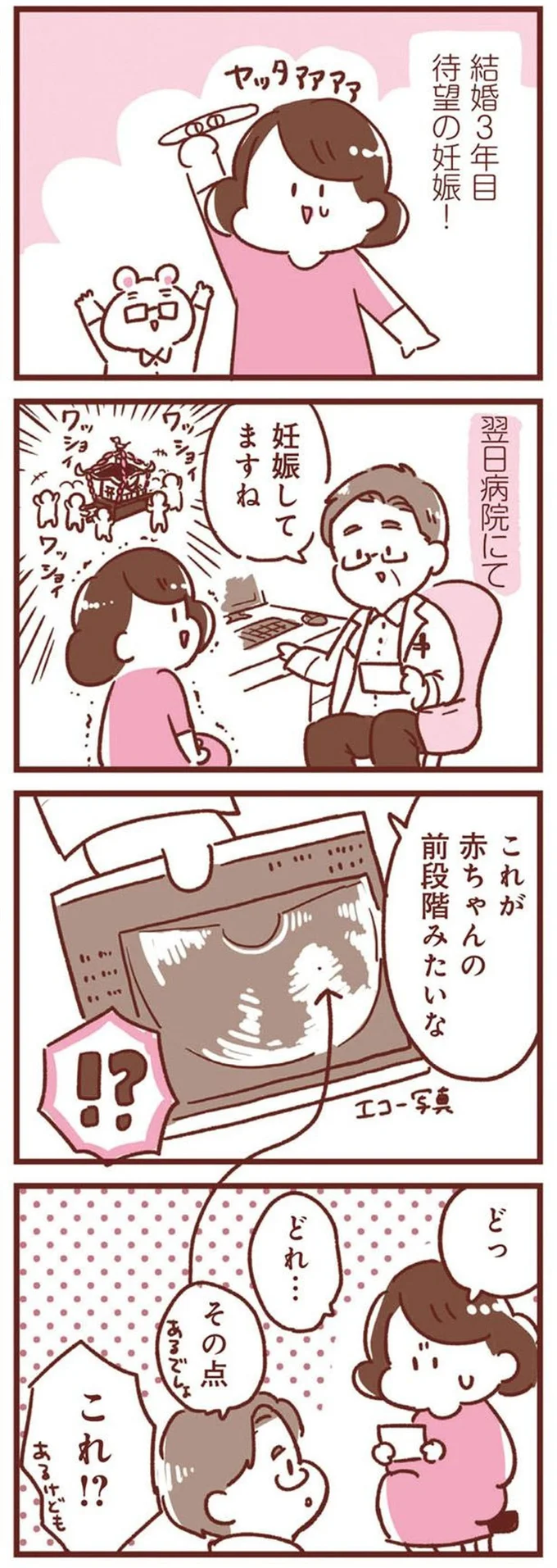 「妊娠してますね」。エコー写真を見せられても「点」しか見えないけど徐々に...!/365日アカチャン満喫生活 14169563.webp