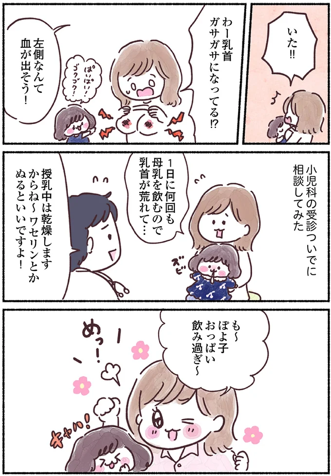 がんを疑うには若すぎた。33歳のママは左胸の上の方の「しこり」が気になったが... 15883816.webp