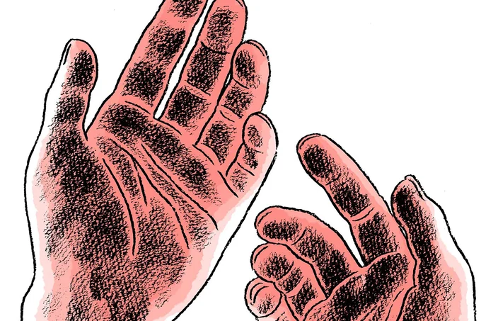 「私に残ったのはこれだけ」原爆が投下された翌日。家族を弔った後、両手についていたもの／わたくし96歳が語る 16歳の夏