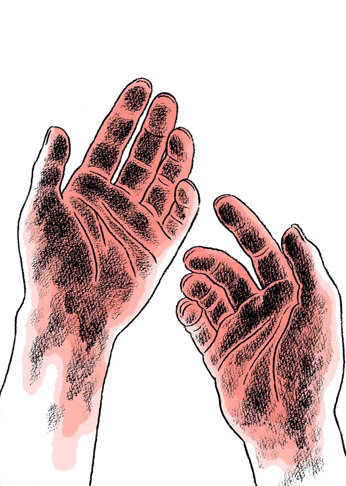 「私に残ったのはこれだけ」原爆が投下された翌日。家族を弔った後、両手についていたもの/わたくし96歳が語る 16歳の夏 19450809_8_1.webp