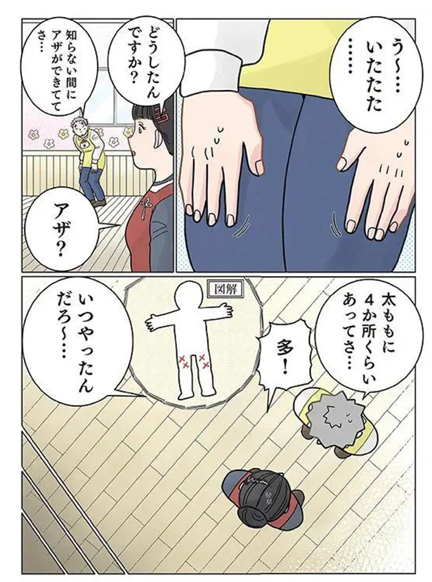 「う～...いたたた」保育士の太ももにできた「謎のアザ」。原因は...あ！／保育士でこ先生4 121.png