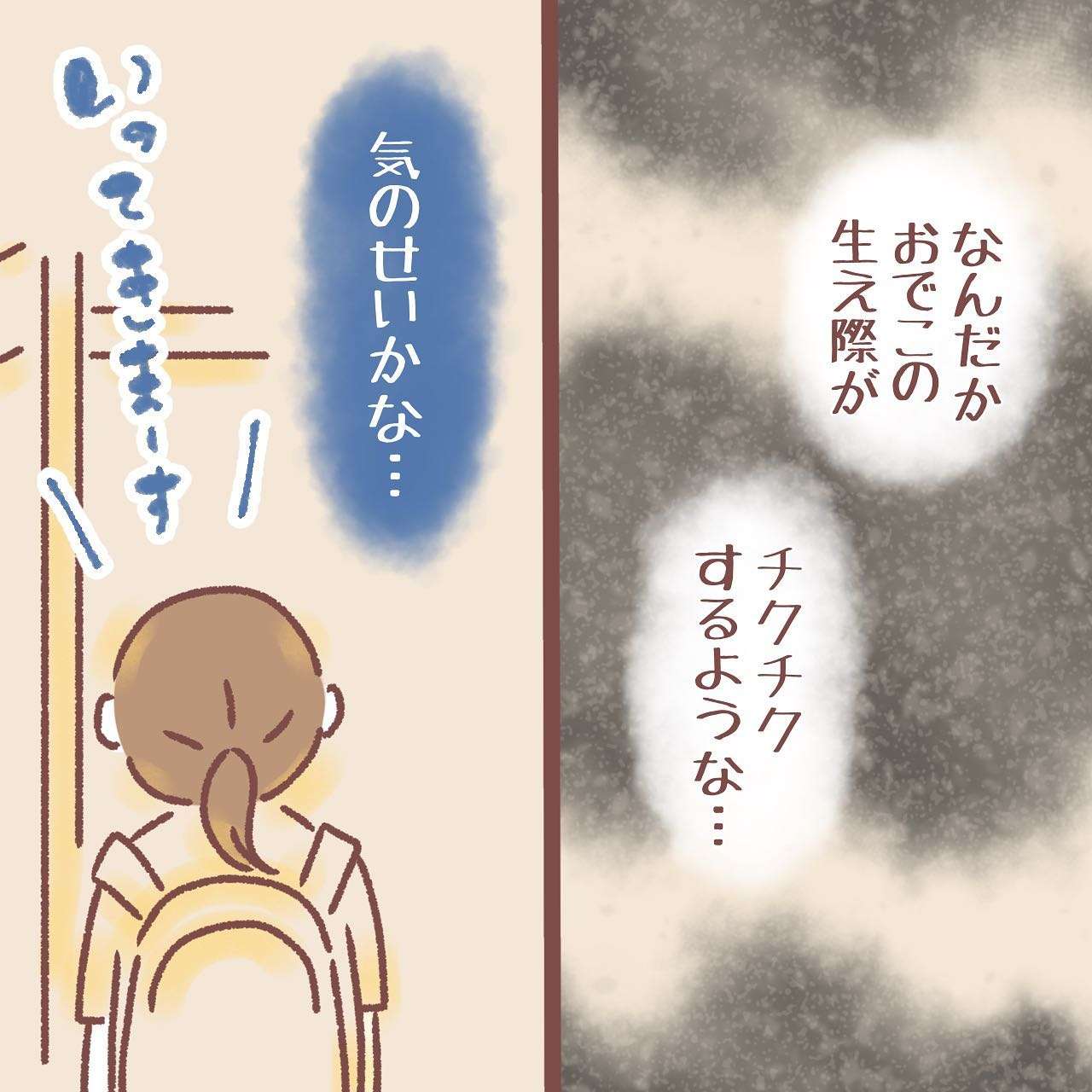 『サヨナラカミノケ〜脱毛症になった話〜』／紅ほっぺ 1_4.jpg