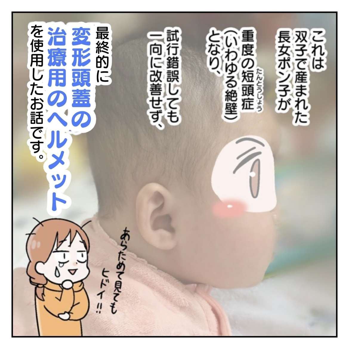 『絶壁の長女がヘルメット治療した話』／サヤ山サヤ IMG_0004 (1).jpeg