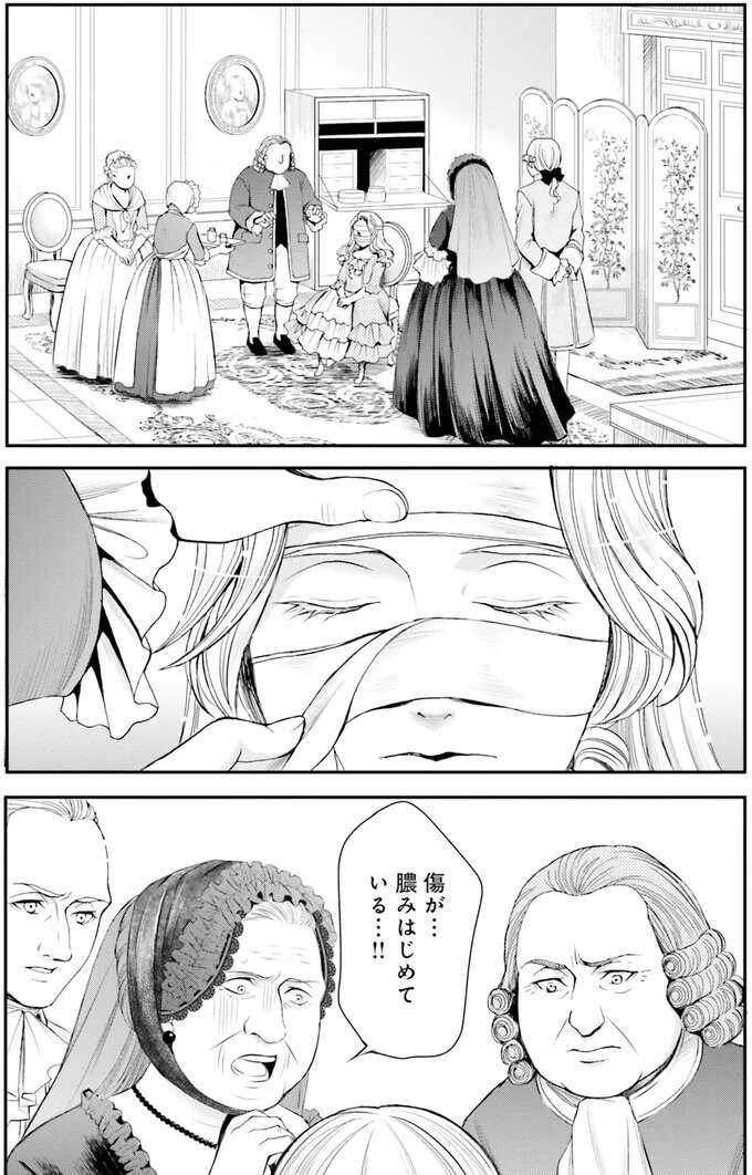 治せなければ死⁉神々しいほど美しい顔に傷を負った皇女/現代OLが18世紀フランスにタイムスリップしたら3 Lamaquilleuse37_1.jpeg