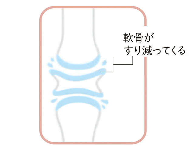 セルフチェックで手指の病気を自己診断！ あなたはどこに痛みを感じますか? P043_02.jpg