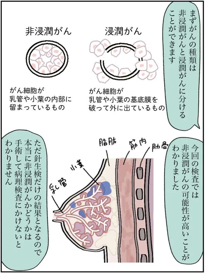 『アラサー会社員の乳がんの備忘録』 arasa5_6.jpeg