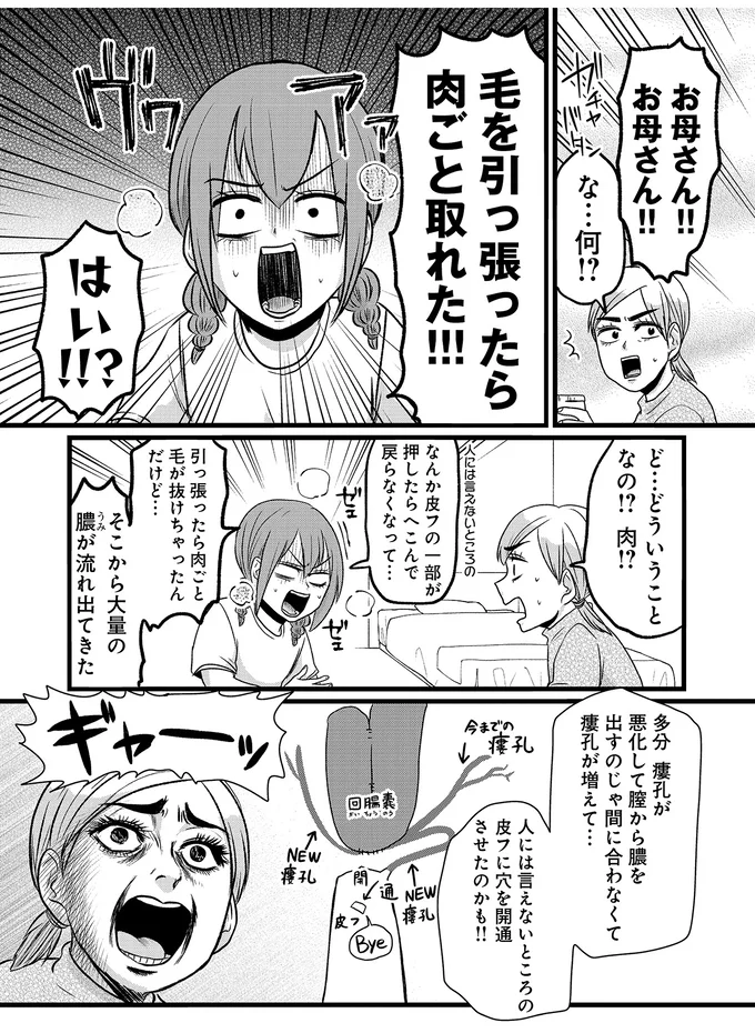 『腸よ鼻よ6〜10』 38-01.png
