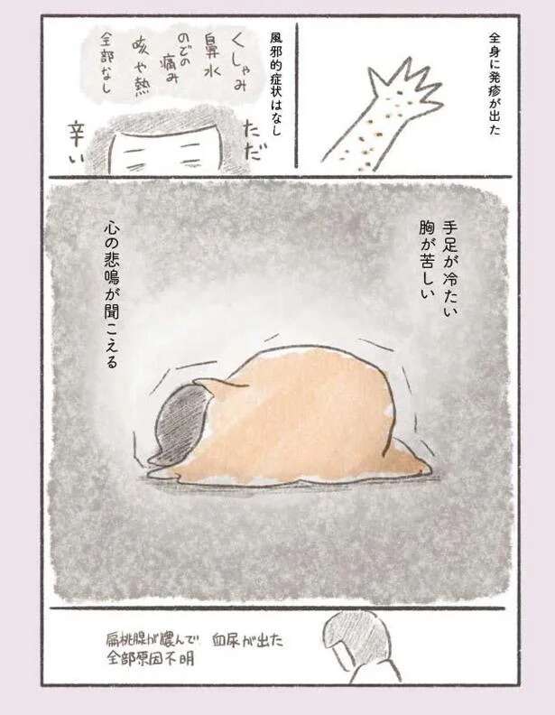 夫を亡くしたストレスから？ 全身に原因不明の発疹が／旦那が突然死にました。 dannagatotsuzen20_1.jpeg