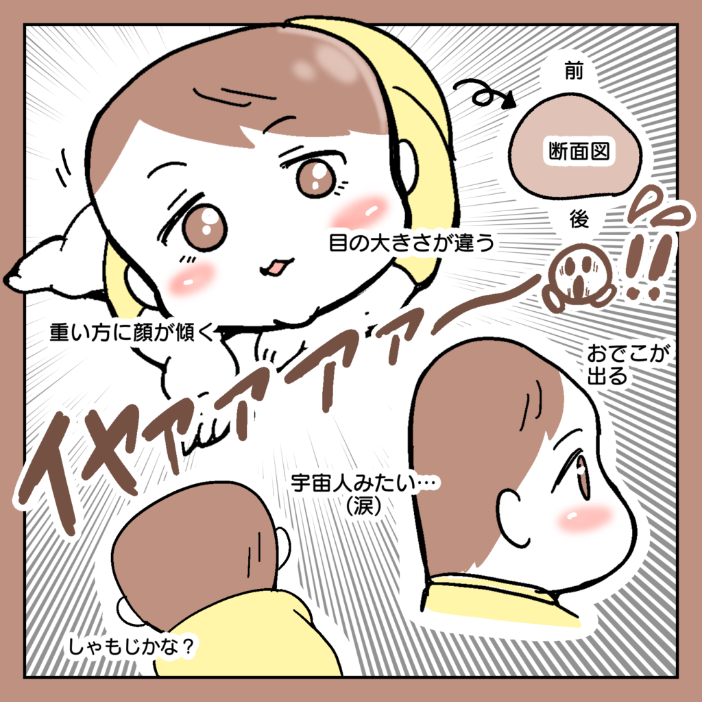 『絶壁の長女がヘルメット治療した話』／サヤ山サヤ export53-1024x1024.png